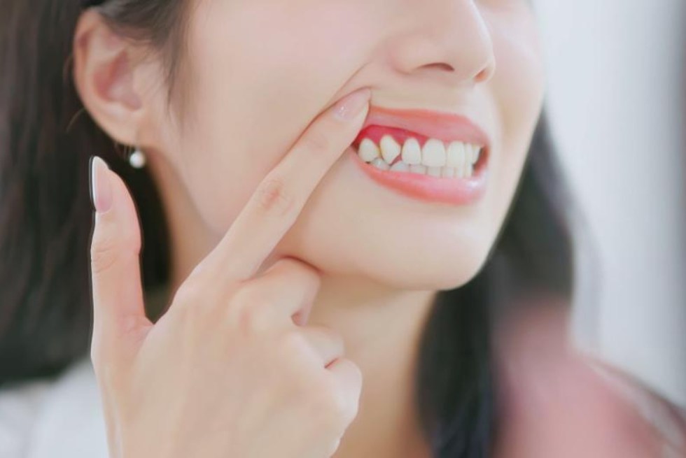 7 Ways to Cure Gum Disease at Home: Expert Guide