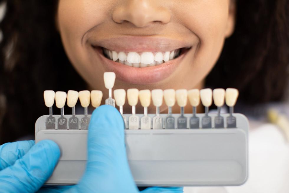 The Biggest Challenge in Cosmetic Dentistry: How to Address Common Dental Restoration Problems and Get the Right Shade for Your Tooth