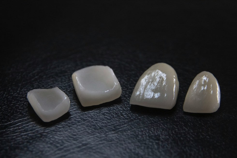 How Long Do Veneers Last? Ultimate Guide