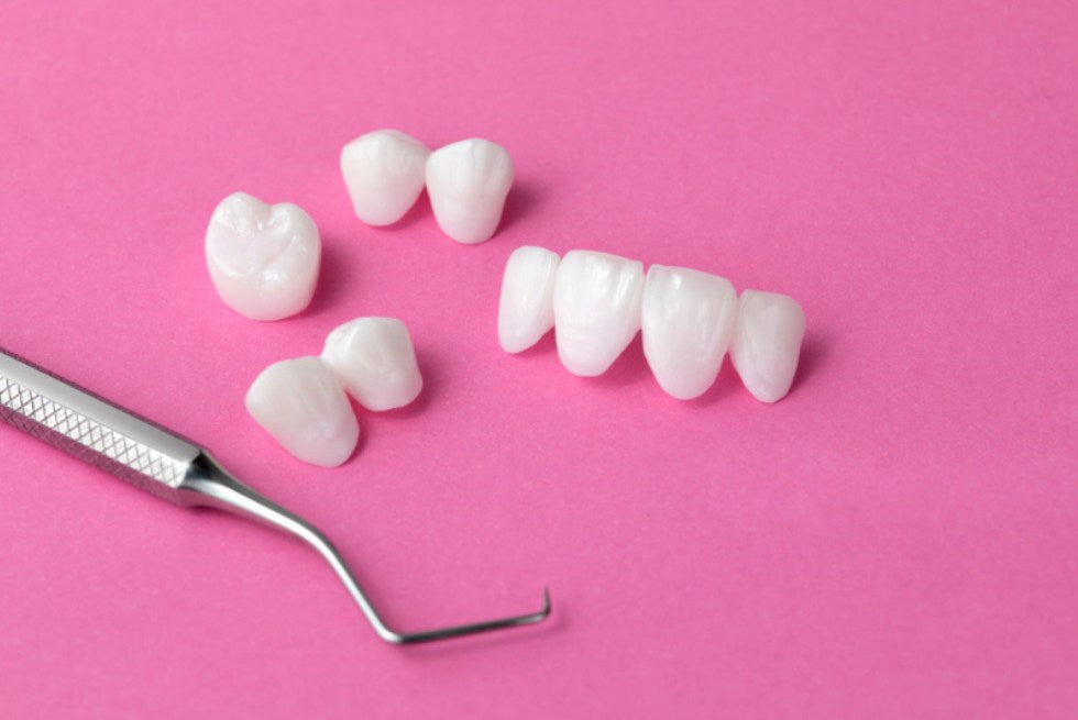 How Much Do Veneers Cost in 2025? Price Breakdown & Savings Tips