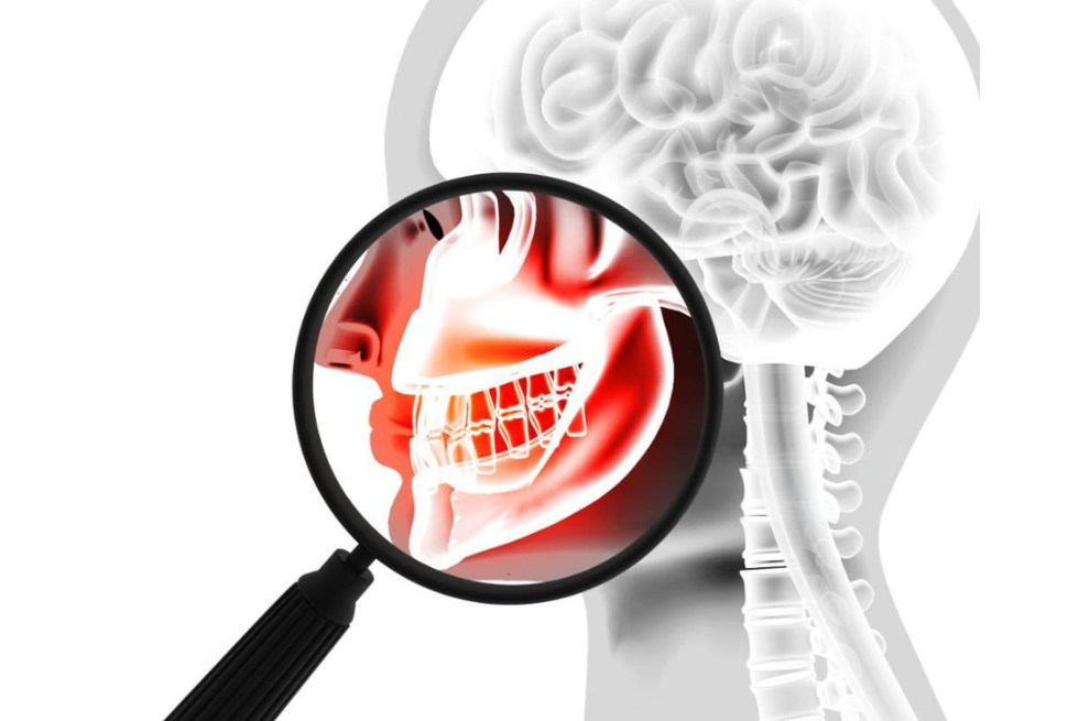 TMJ Disorder: Causes, Symptoms & Treatment Guide