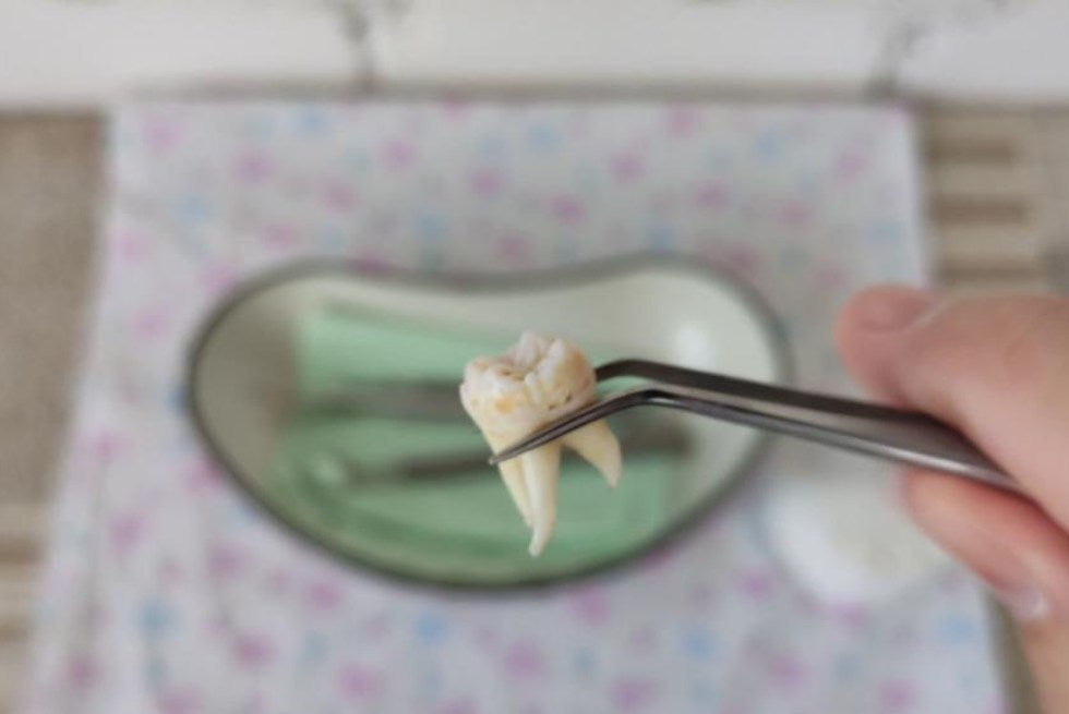 What to Eat After Wisdom Teeth Removal: Food Guide