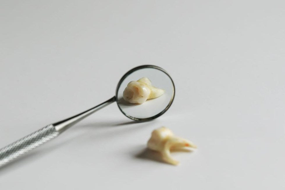 Wisdom Teeth: What They Are & When To Remove Them