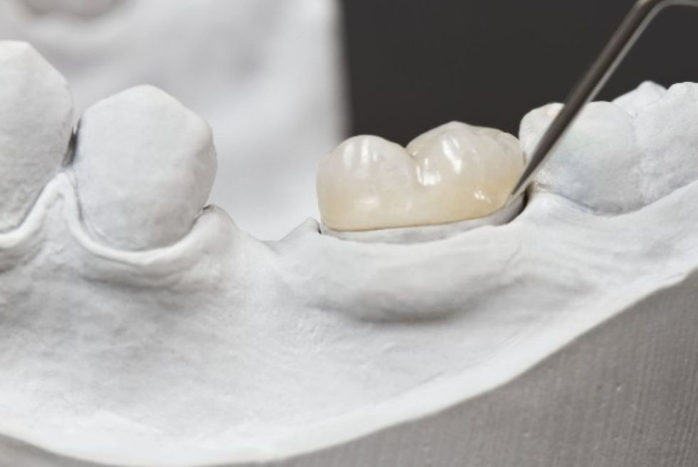Zirconia Dental Crowns: Advantages and Disadvantages