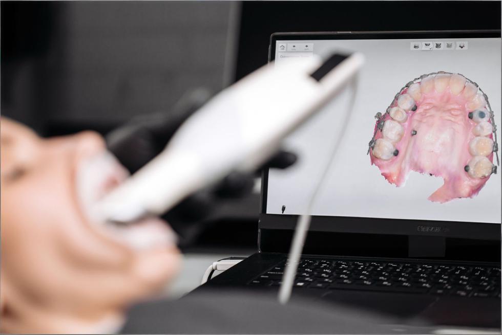 The Complete Introduction to Intraoral Scanning