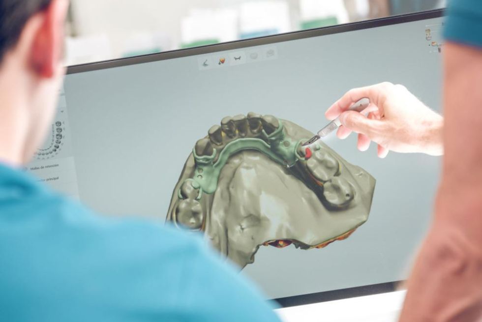 CAD/CAM Systems in Dentistry