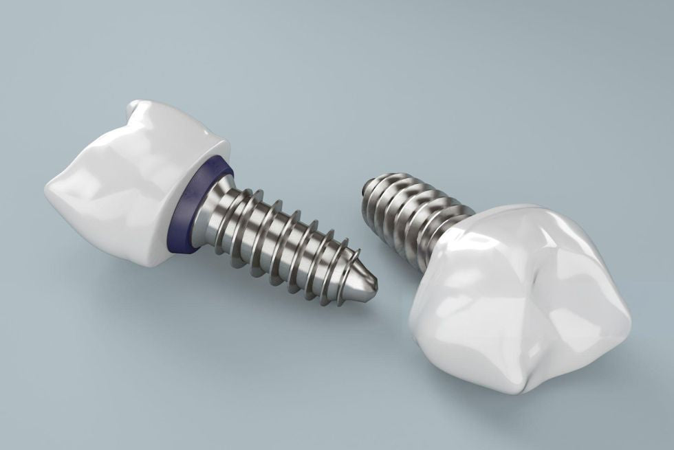 Custom vs. Stock Dental Implant Abutments