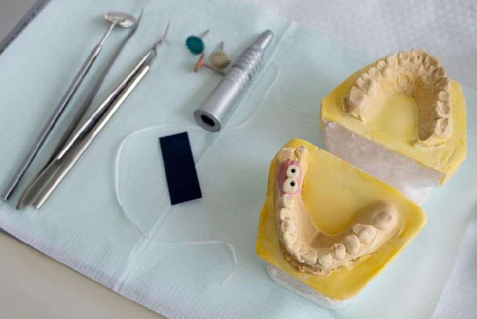 The Cheapest State to Get Dental Implants: An Insider's Guide to Save Money on Your Smile