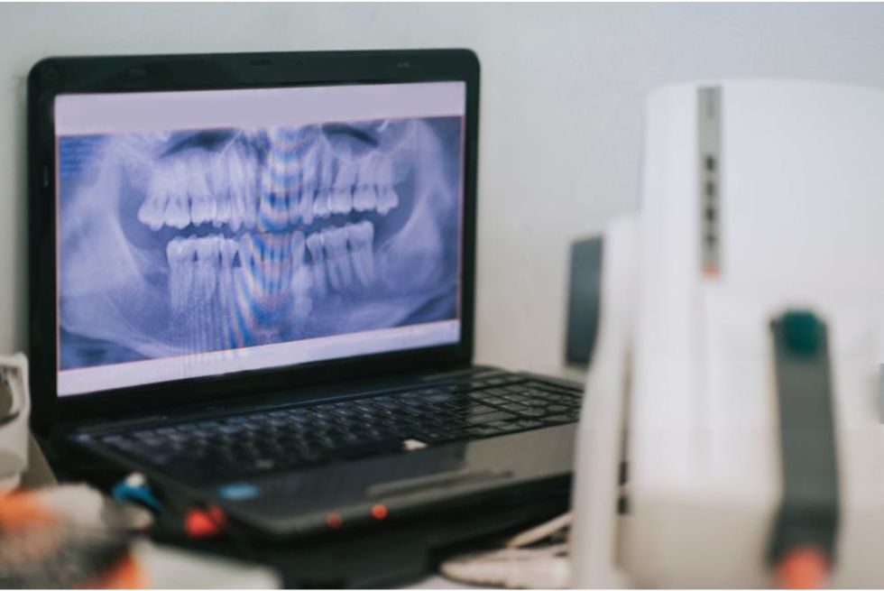 Dental X-Ray Machine Cost