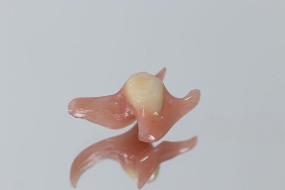 Flexible vs Acrylic Partial Dentures: Choose the Best