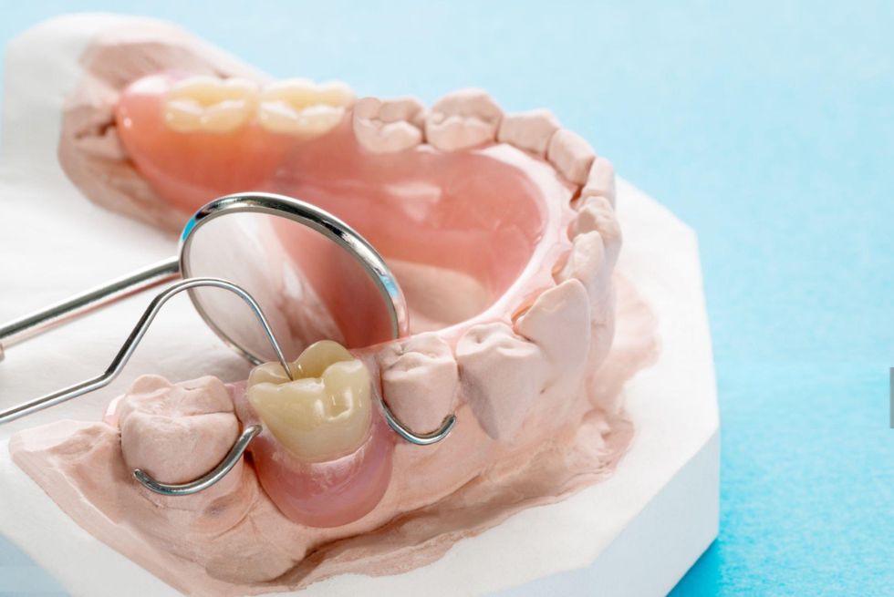 Different Types of Partial Dentures: Complete Guide