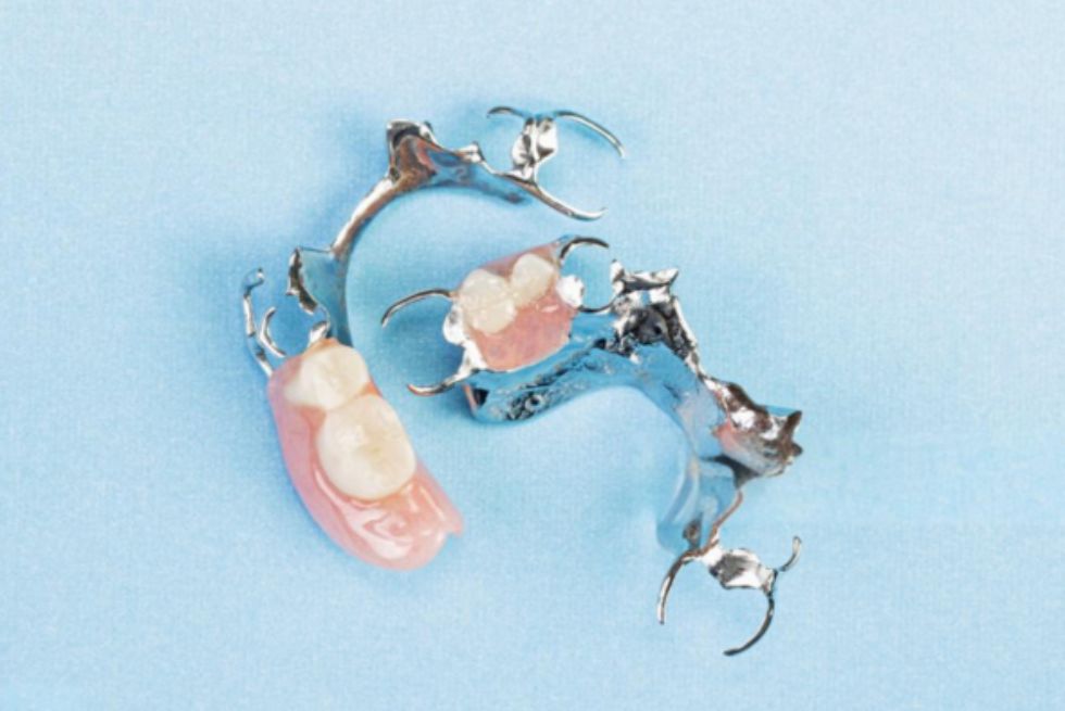 Choosing the Right Partial Denture Clasp Types