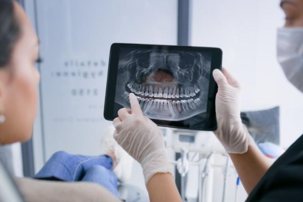 Types of Oral Surgery