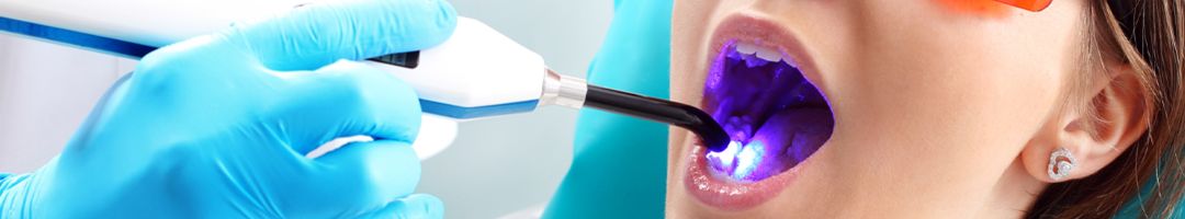 Dental Curing Light