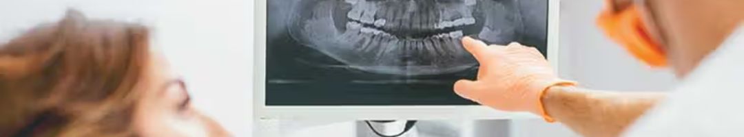 Dental X Ray