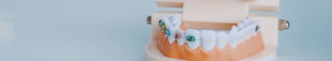 Metal Dental Braces