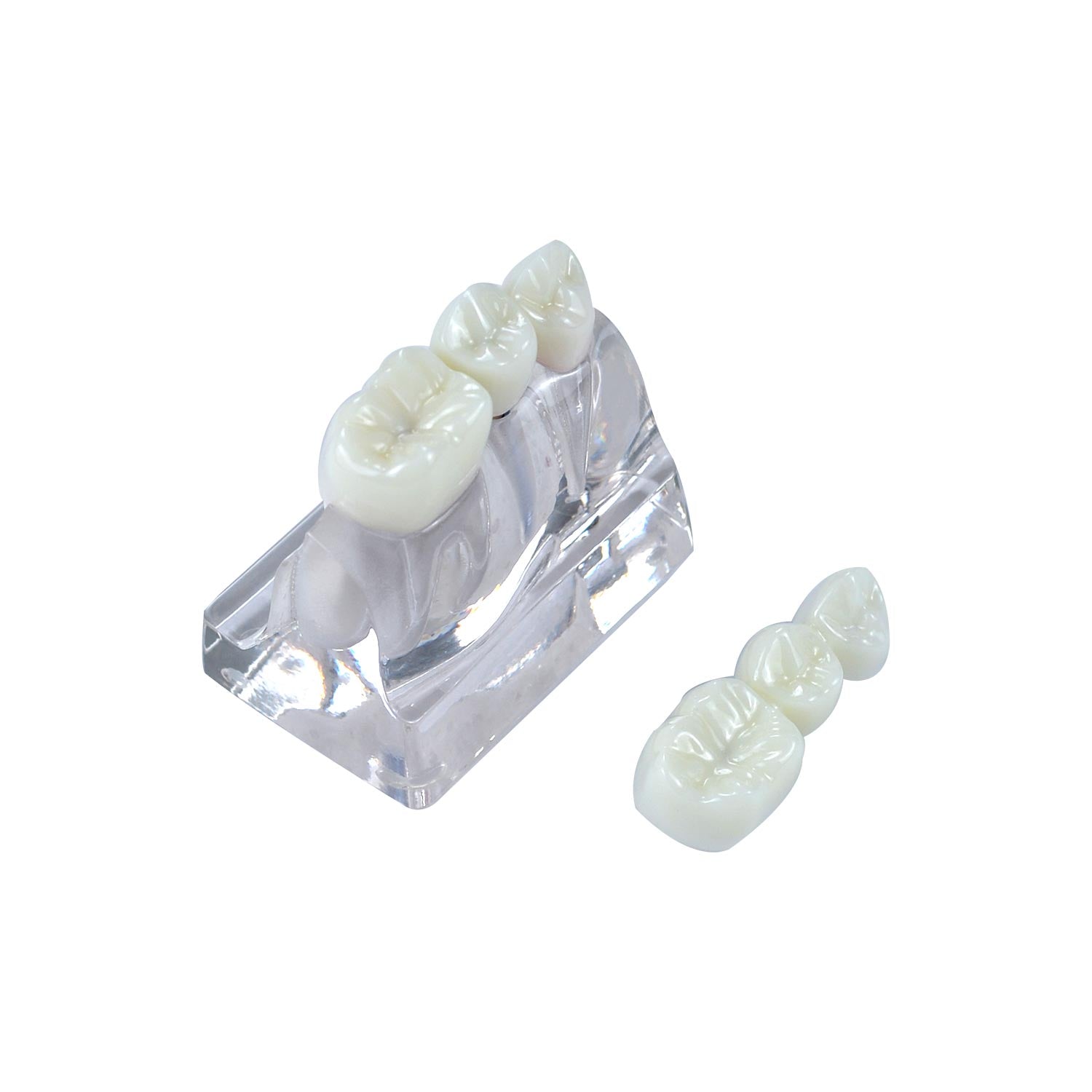 Dental Implant Demonstration Model, Transparent 4x Triple Crown Implant Display Model