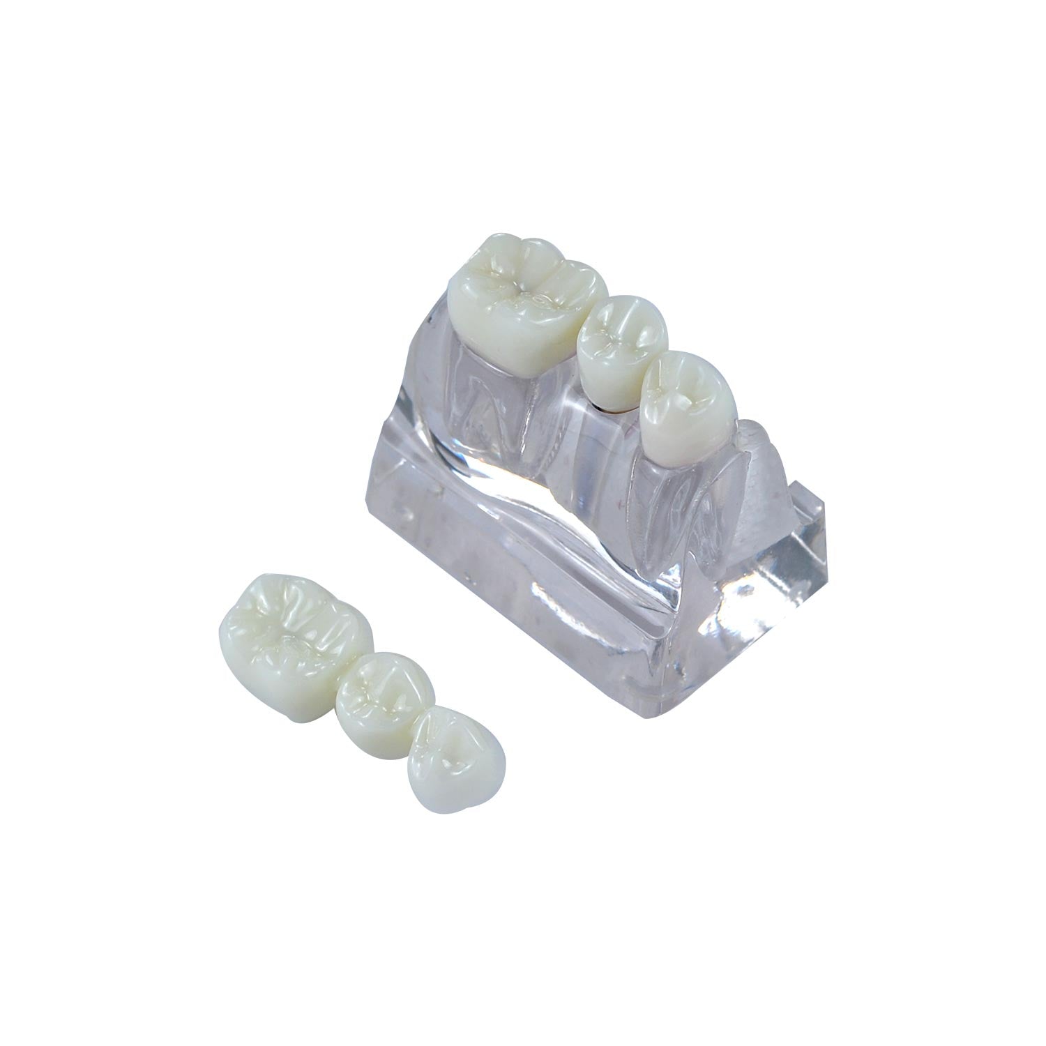 Dental Implant Demonstration Model, Transparent 4x Triple Crown Implant Display Model