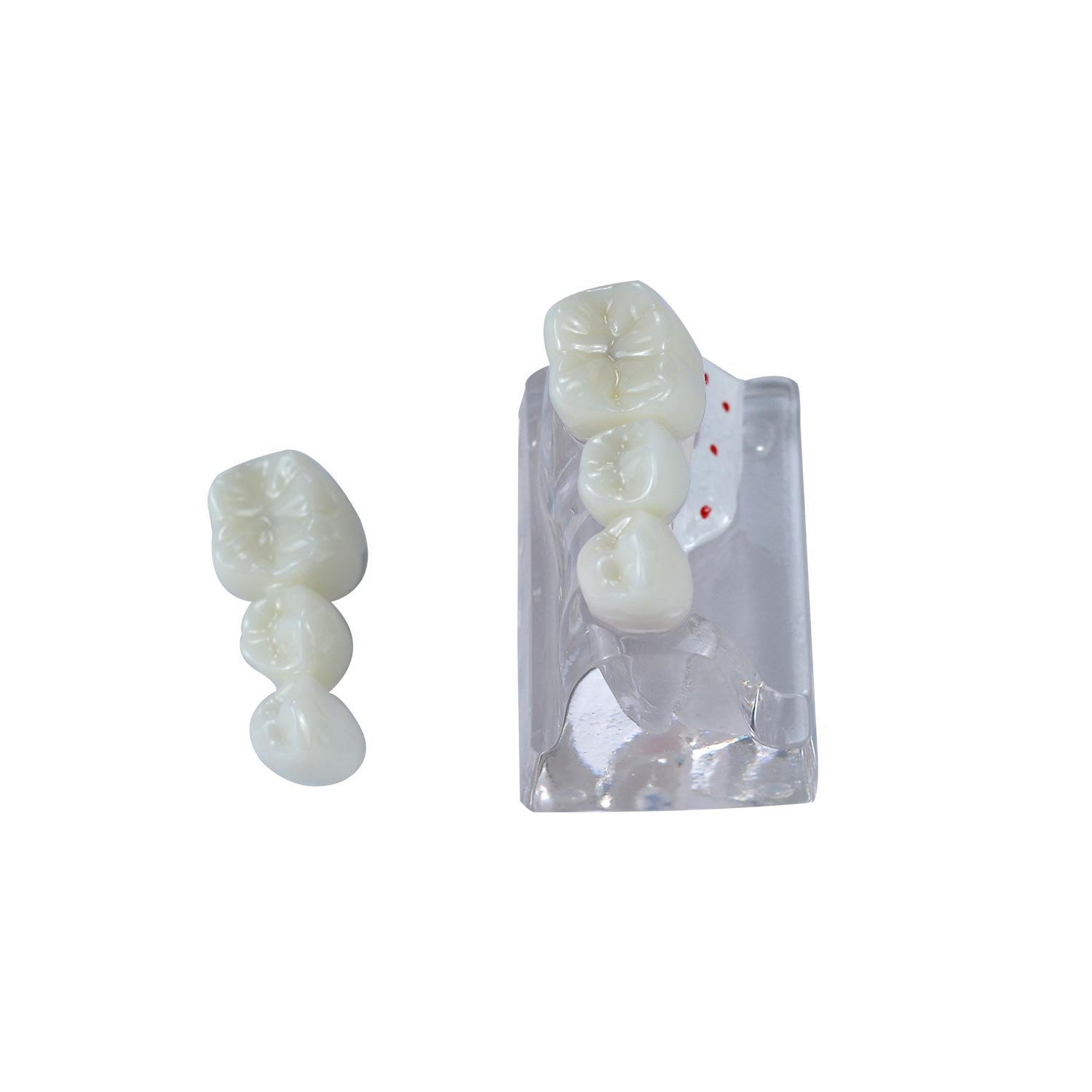 Dental Implant Demonstration Model, Transparent 4x Triple Crown Implant Display Model