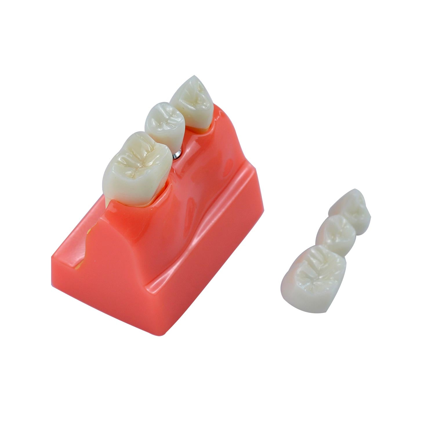 Dental Implant Model, 4x Triple Crown Implant Display Model