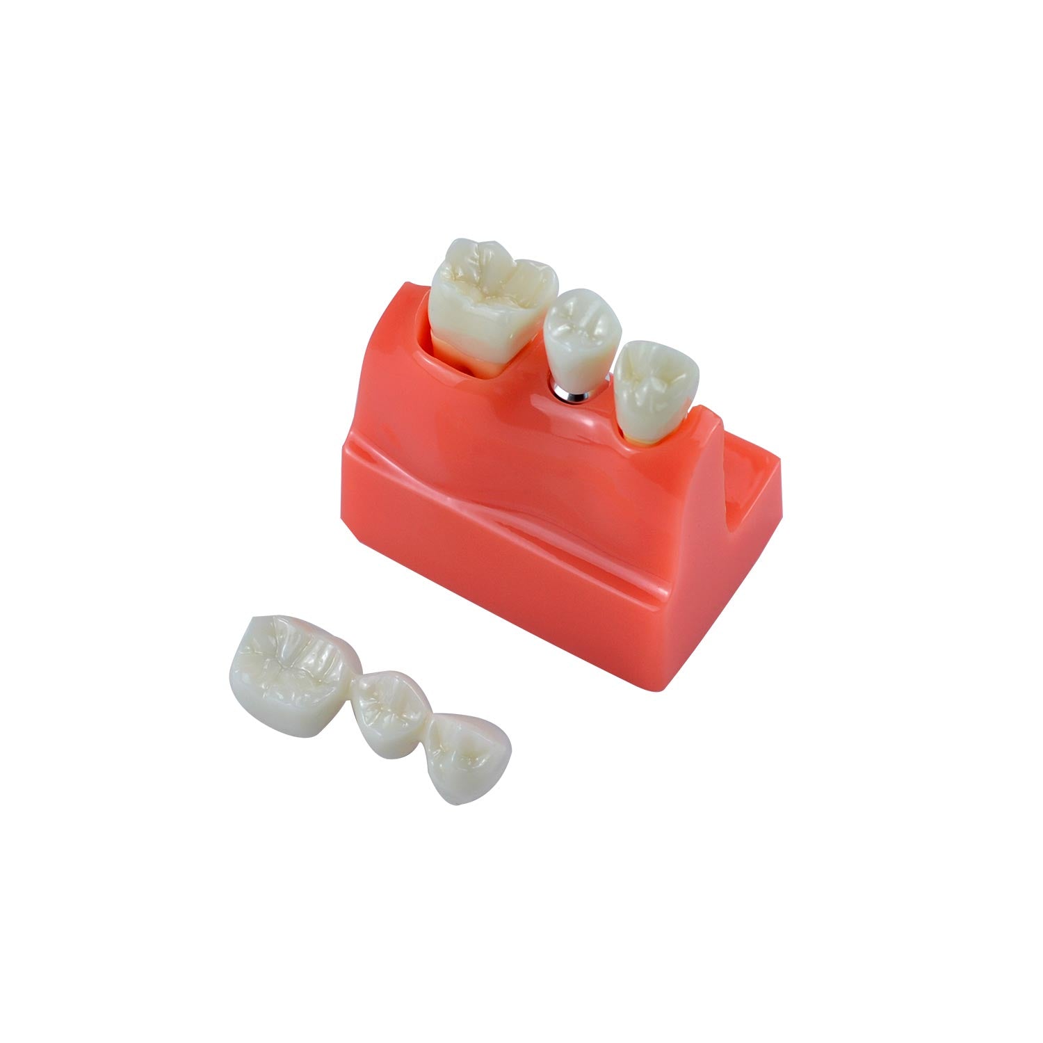 Dental Implant Model, 4x Triple Crown Implant Display Model