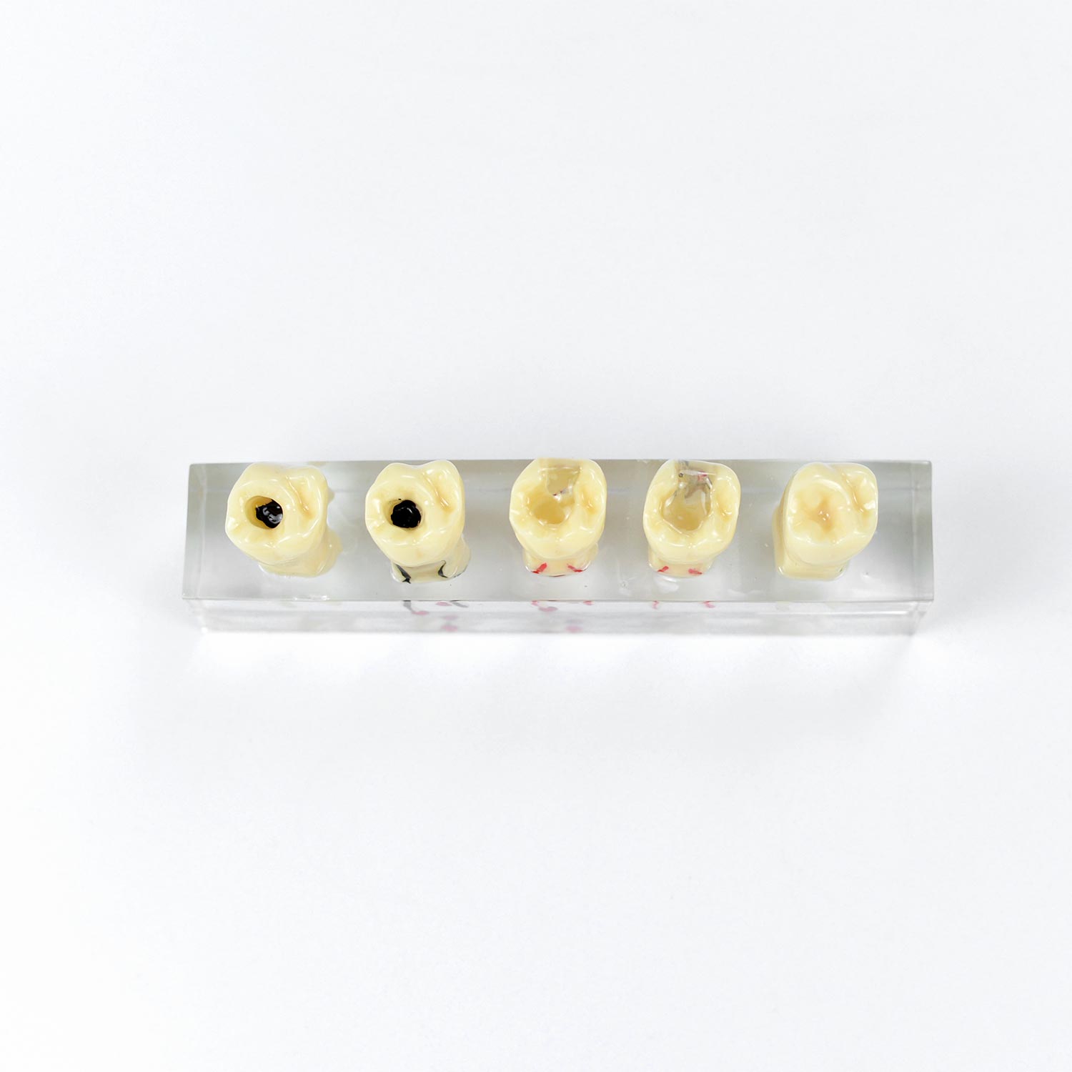 Dental Root Canal Model
