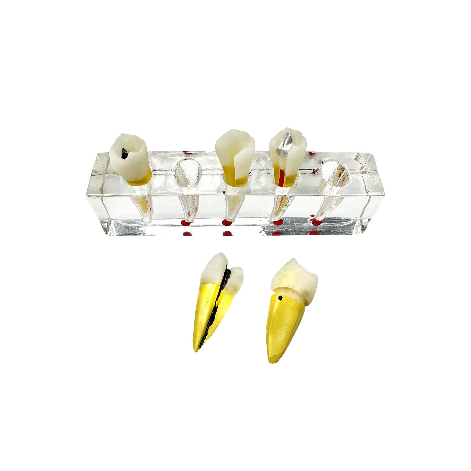 Dental Root Tip Cyst Model, Endodontic Treatment Teeth Models For Education