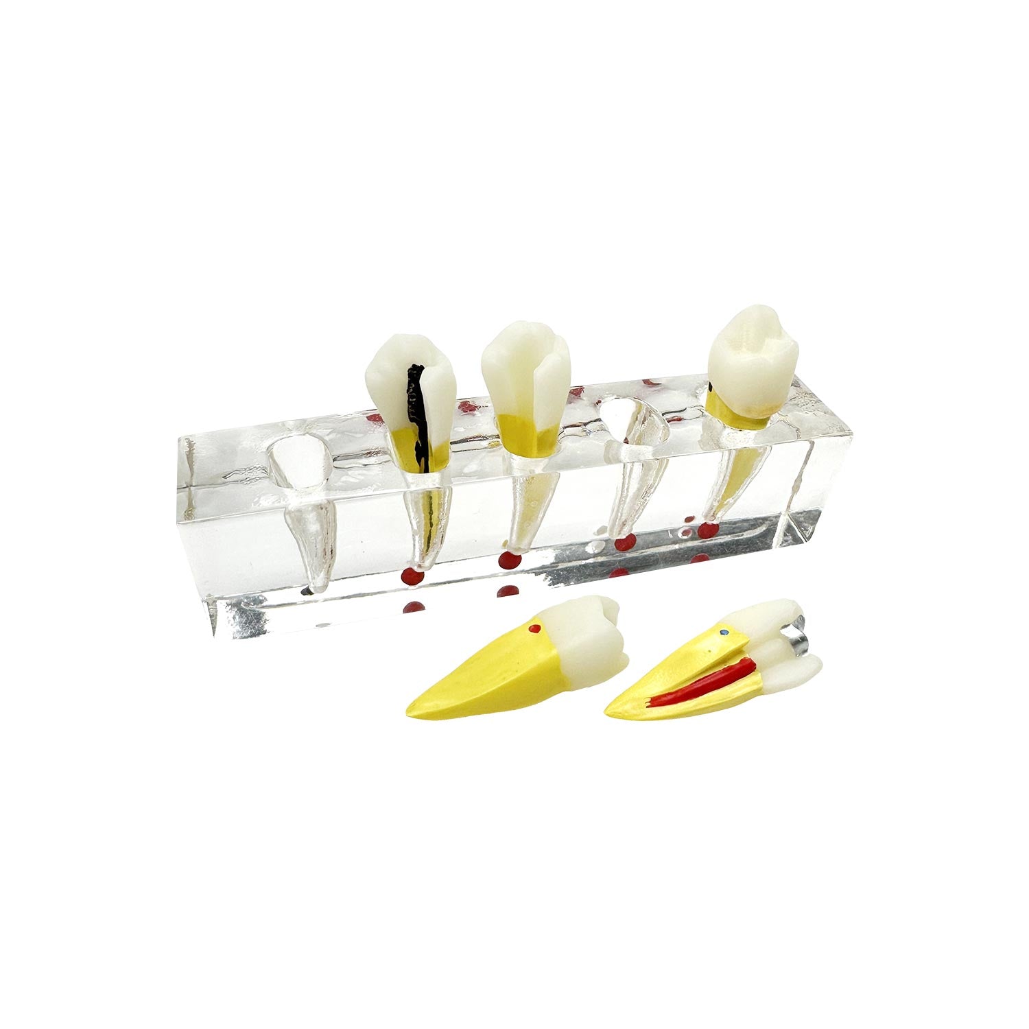 Dental Root Tip Cyst Model, Endodontic Treatment Teeth Models For Education