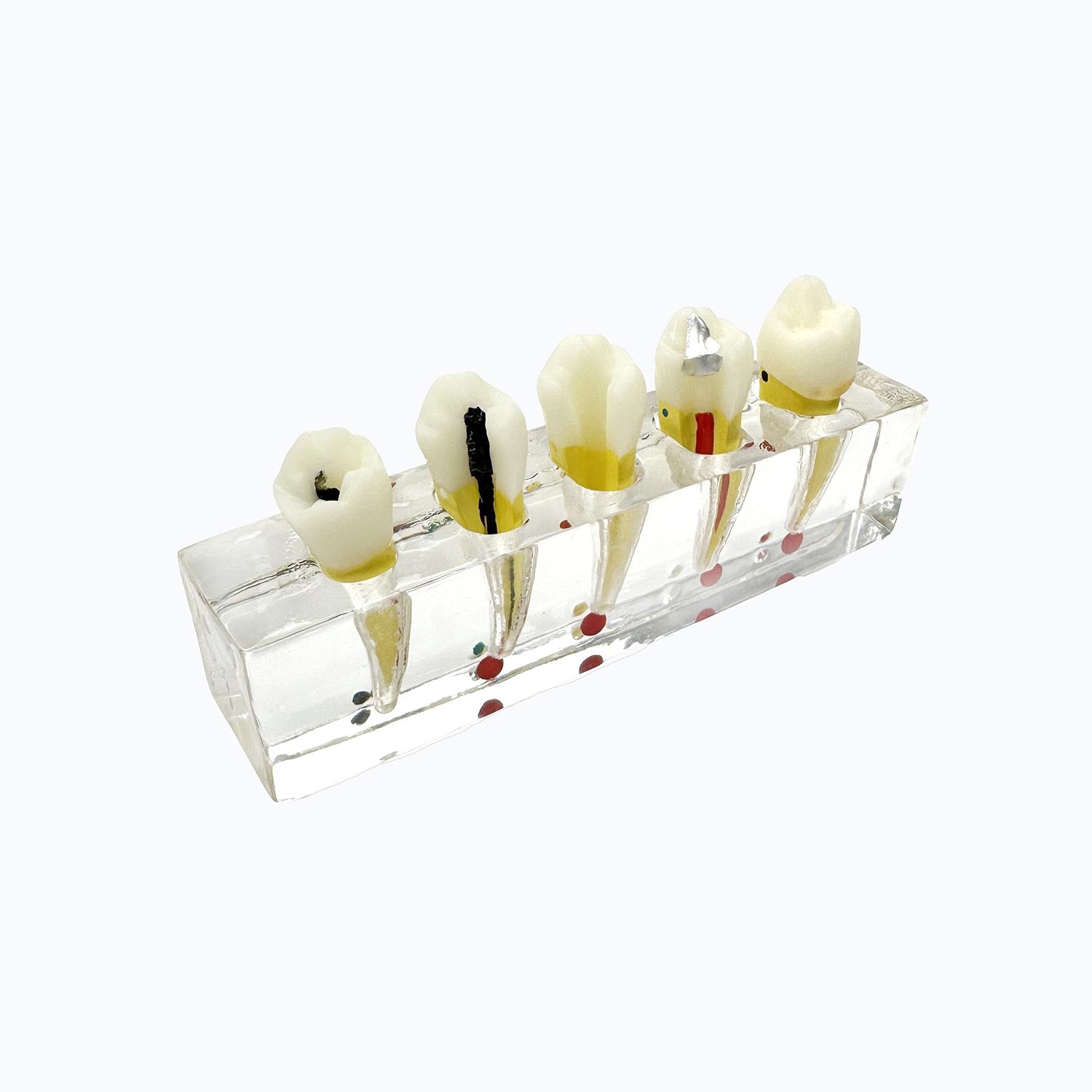 Dental Root Tip Cyst Model, Endodontic Treatment Teeth Models For Education