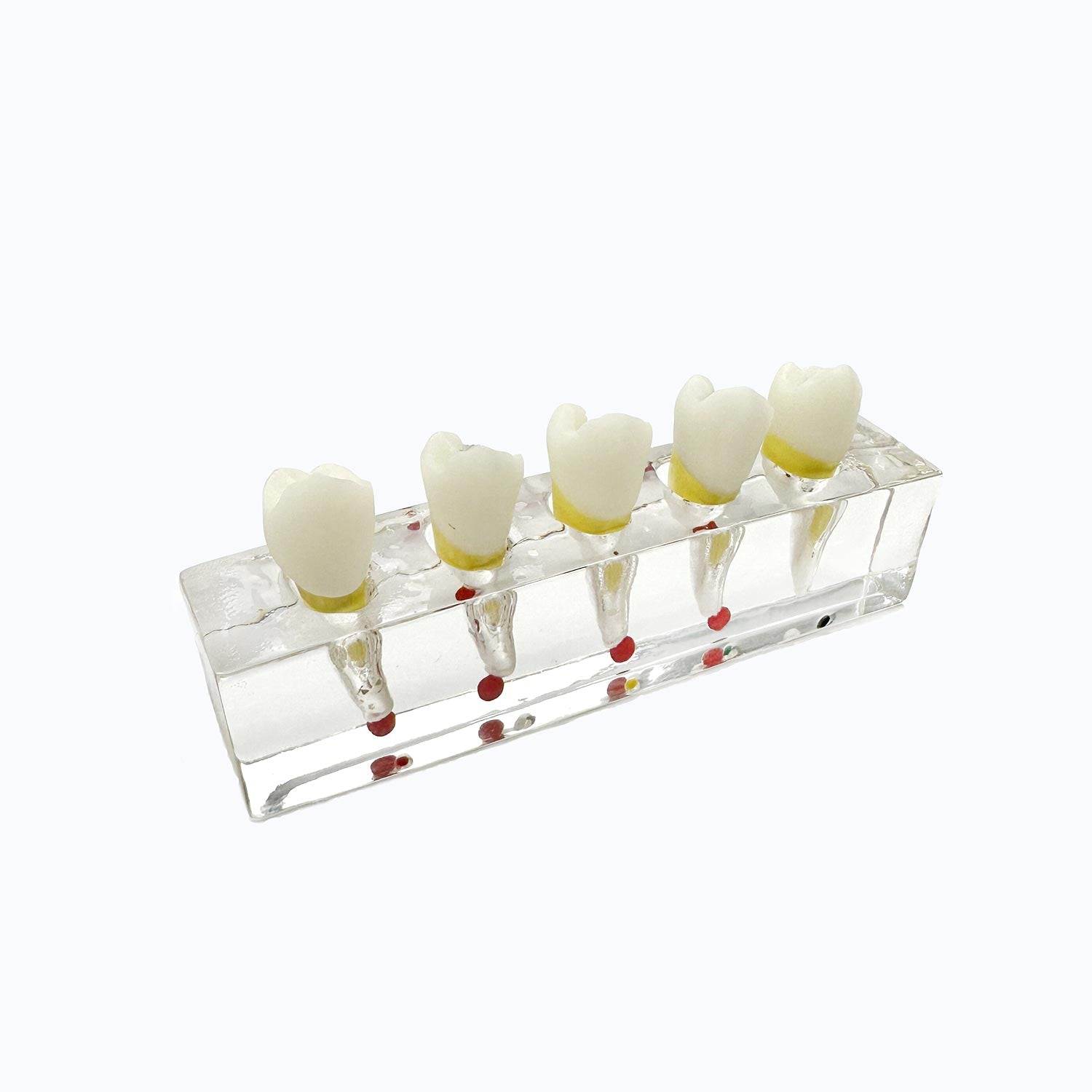 Dental Root Tip Cyst Model, Endodontic Treatment Teeth Models For Education