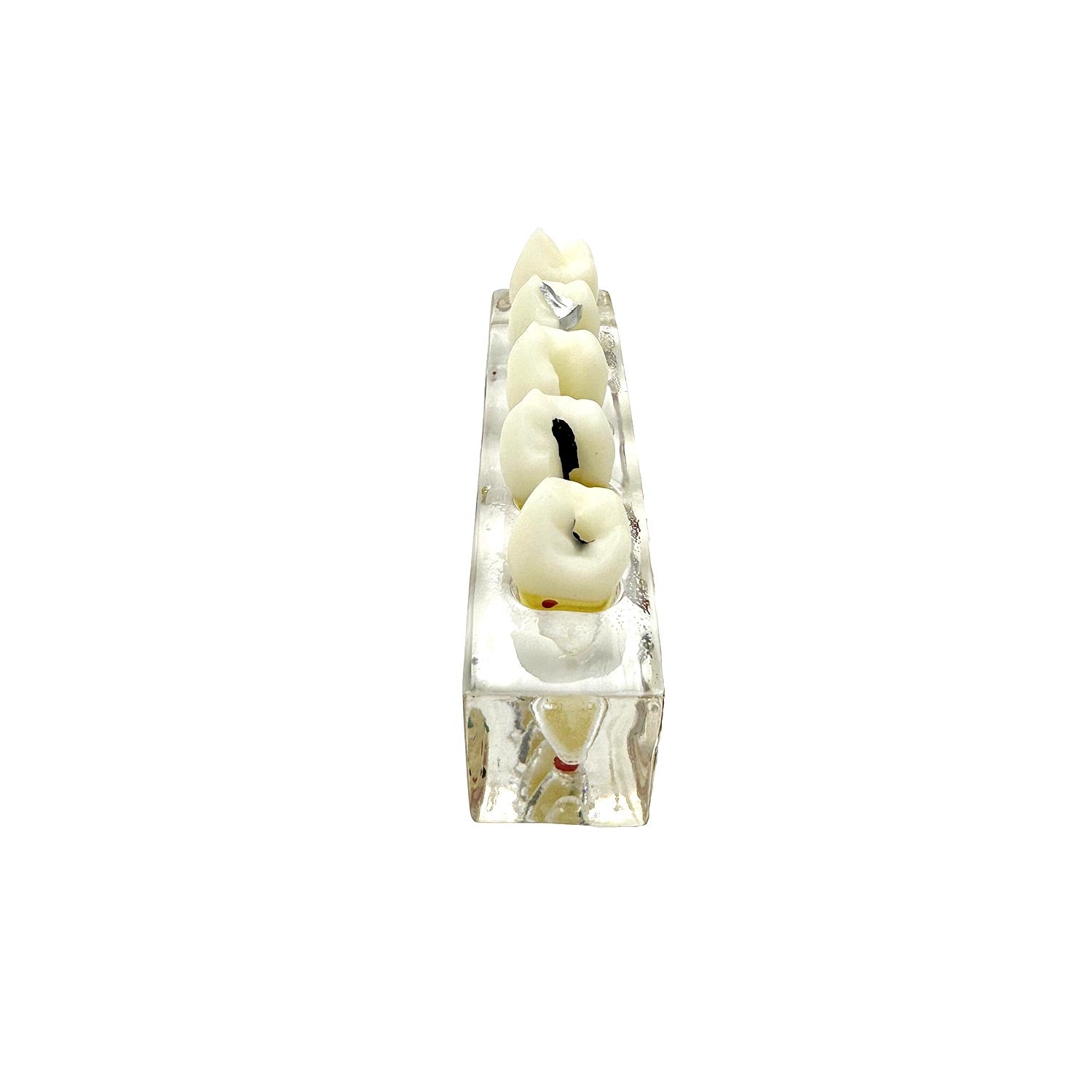 Dental Root Tip Cyst Model, Endodontic Treatment Teeth Models For Education