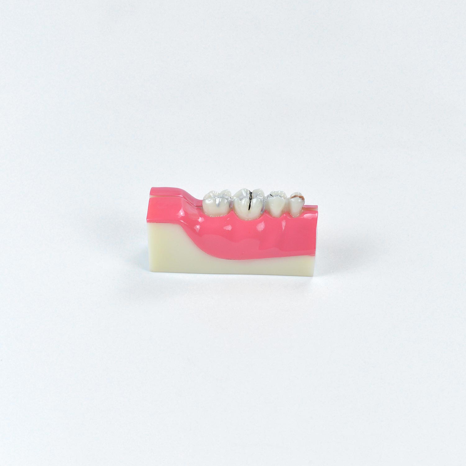 Dental Teeth Anatomy Model, Anatomical Model Of Right Lower Back Teeth