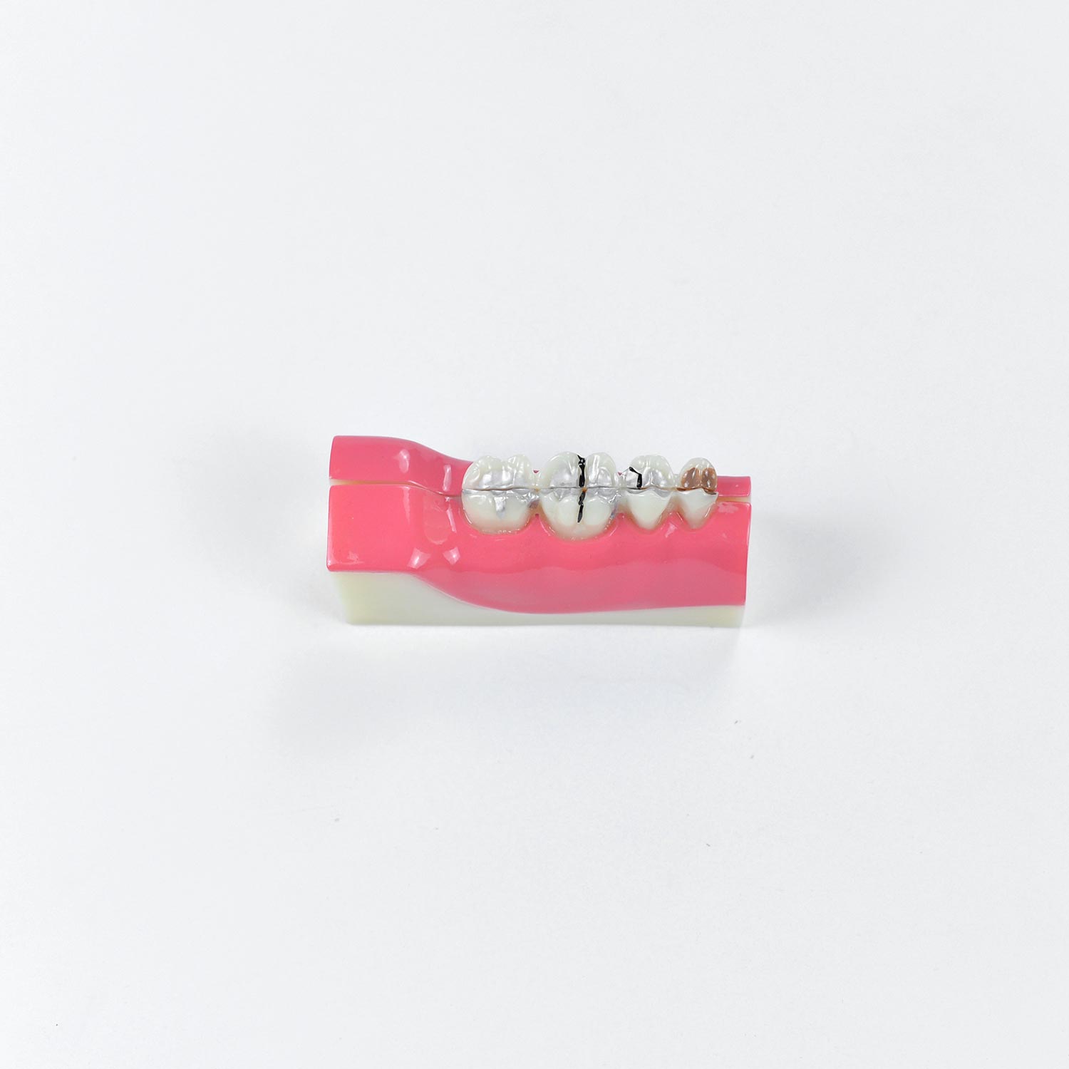 Dental Teeth Anatomy Model, Anatomical Model Of Right Lower Back Teeth