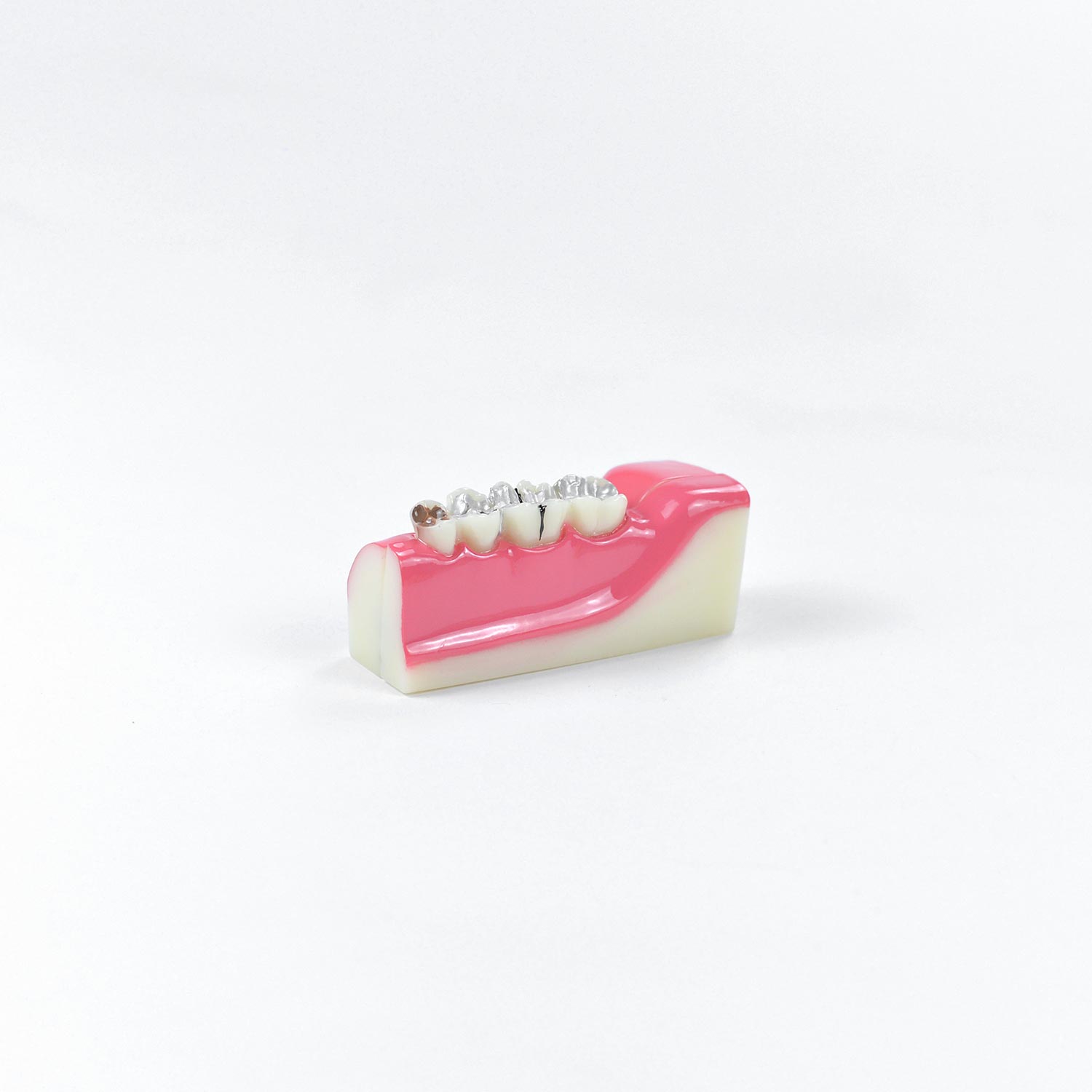 Dental Teeth Anatomy Model, Anatomical Model Of Right Lower Back Teeth