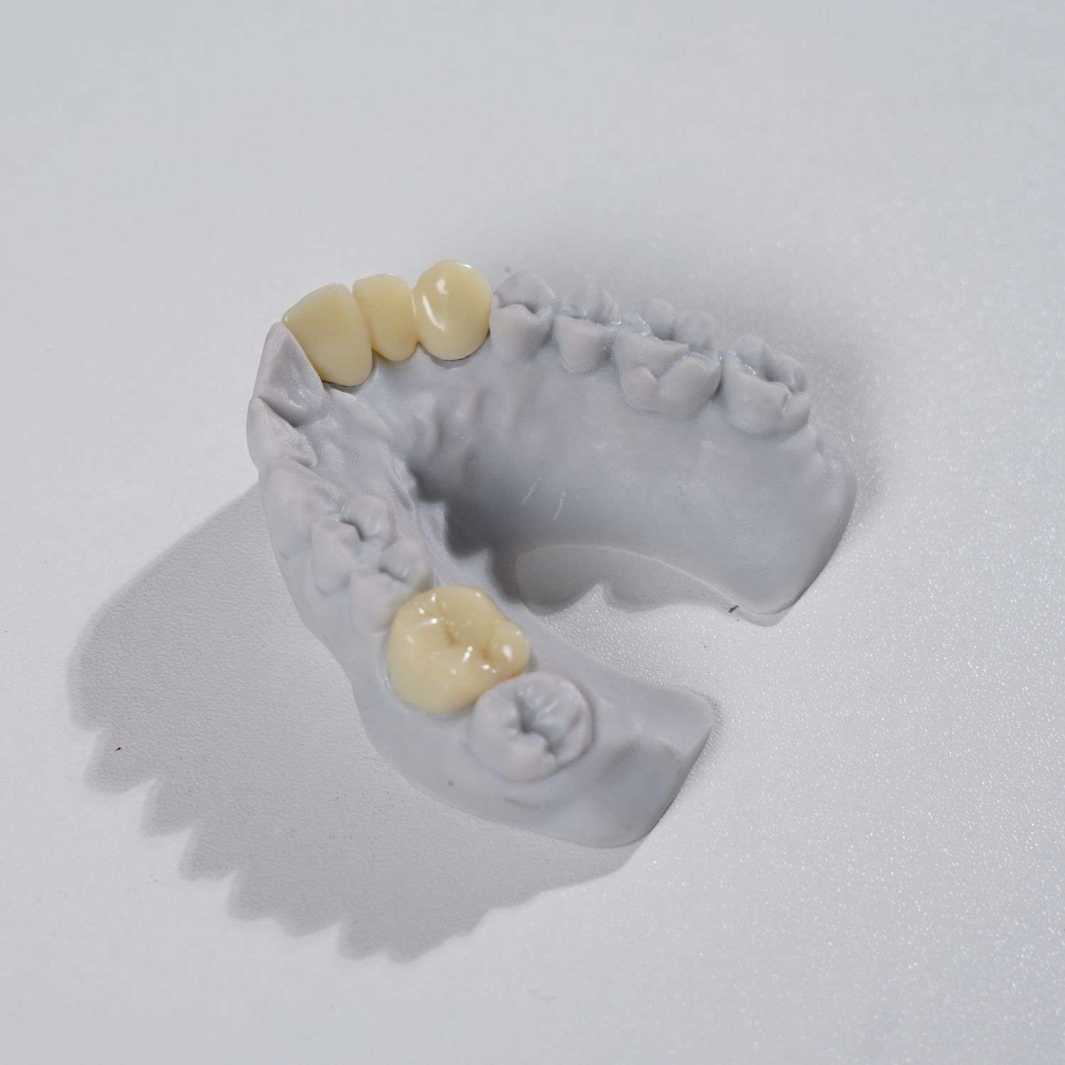 Impressora dental 3D LCD, equipamento de impressora de resina de laboratório dentário para dentaduras CAD CAM